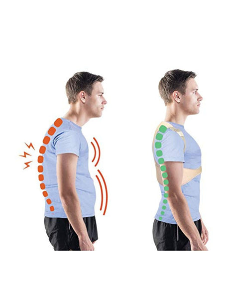 Posture Corrector